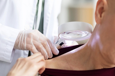 Трихолог Егорова объяснила появление красных &laquo;родинок&raquo; на теле